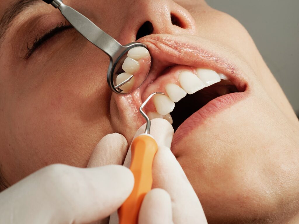 Kosmetisk tandbehandling: Hvilke muligheder er der?